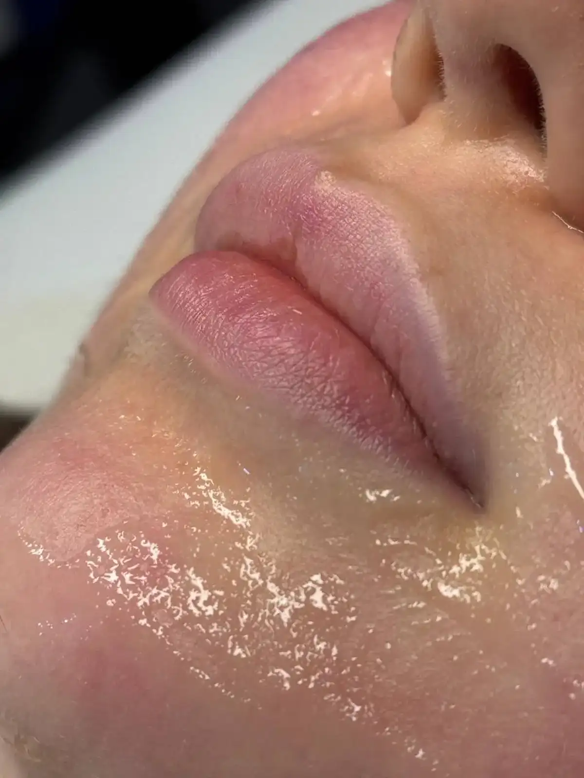 hiba_lips_before_1200x1600 (1)